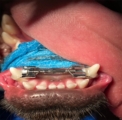 Kieferorthopäde Hund Linden